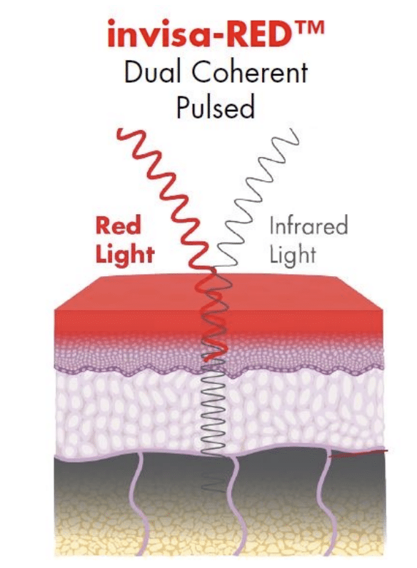 invisa-RED dual coherent pulse